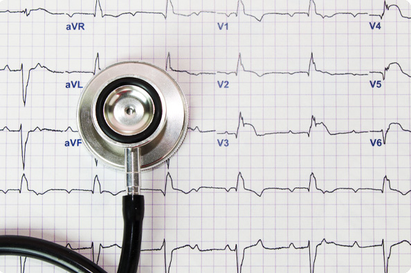 Cardiologist reviewing coronary angiogram