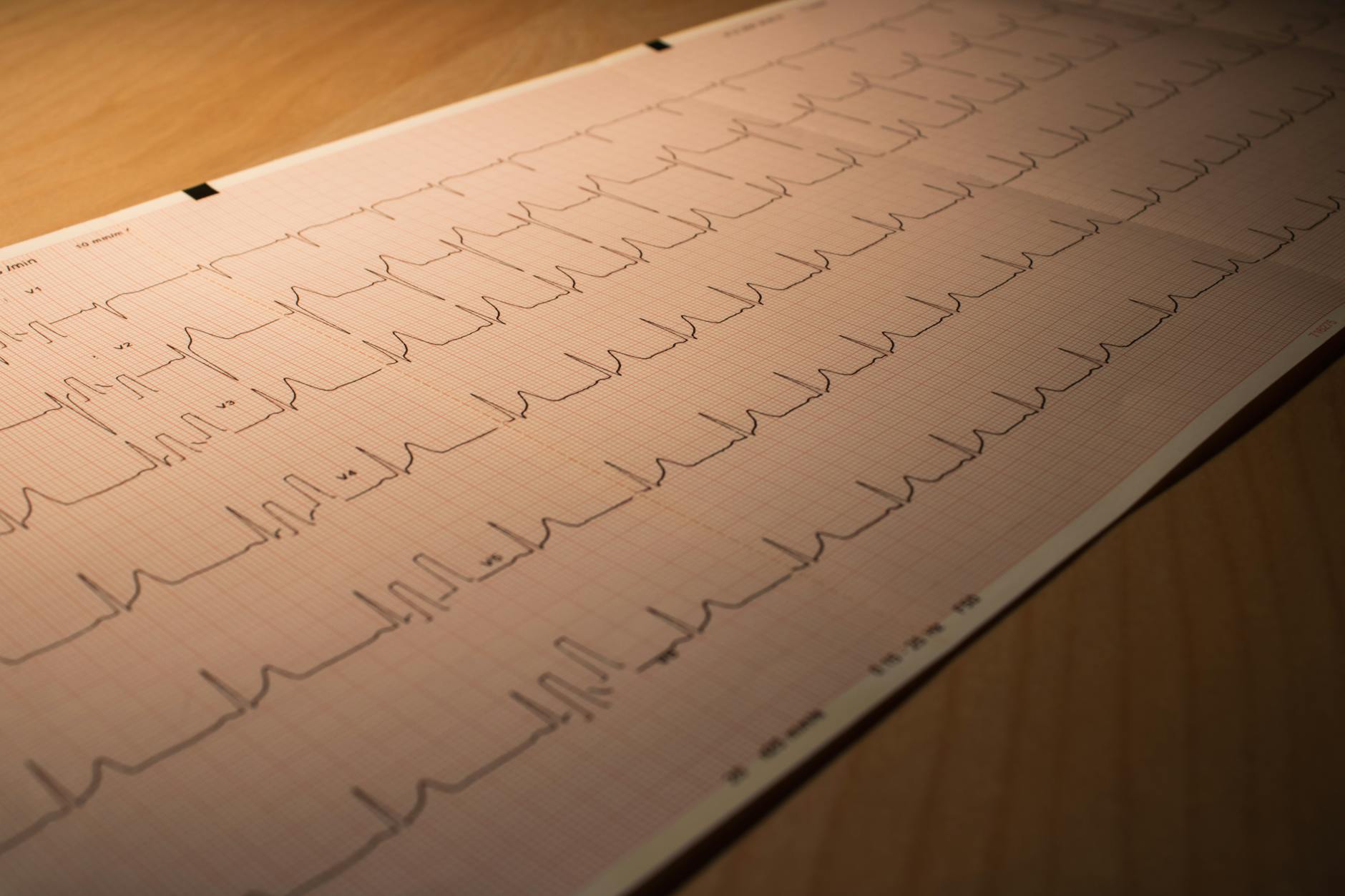 Cardiology causation expert report on a desk with ECG trace