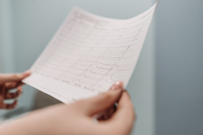 Evidence-Based Mortality Projections in Fatal Cardiac Claims
